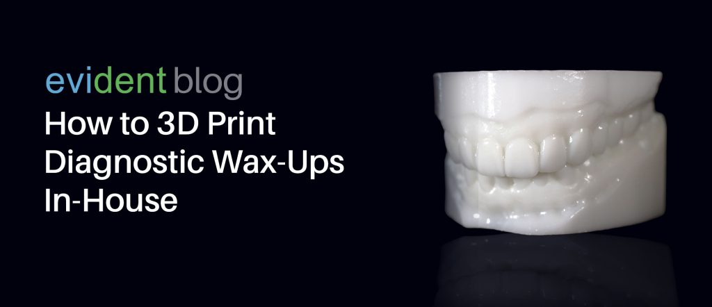 3D print diagnostic wax-ups