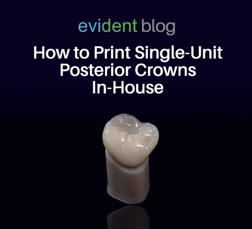 3D Print single-unit crowns