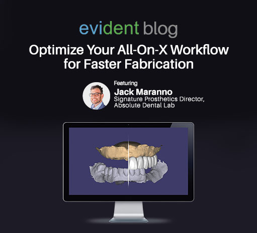 all-on-x workflow