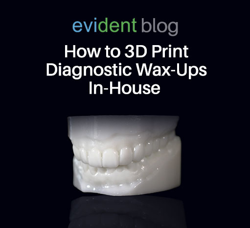 3D print diagnostic wax up