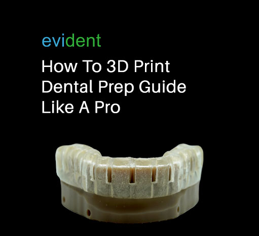 dental prep guide